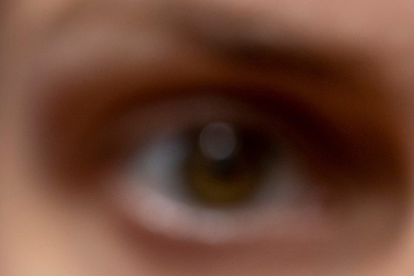 Eye Movement Therapy (EMDR)